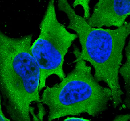 Immunocytochemistry Laminin S/Laminin beta 2 Antibody (C4) [Unconjugated]