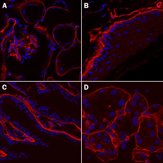 Laminin  alpha 1/ beta 1 was detected in perfusion fixed frozen sections of mouse kidney glomeruli (panel A), skin (panel B), intestine (panel C), and skeletal muscle (panel D) using Rat Anti-Mouse Laminin  alpha 1/ beta 1 Monoclonal Antibody (Catalog # MAB4656) at 10 µg/mL overnight at 4 °C. Tissue was stained using the NorthernLights™ 557-conjugated Anti-Rat IgG Secondary Antibody (red; Catalog # NL013) and counterstained with DAPI (blue). Specific staining was localized to cell surfaces. View our protocol for Fluorescent IHC Staining of Frozen Tissue Sections.
