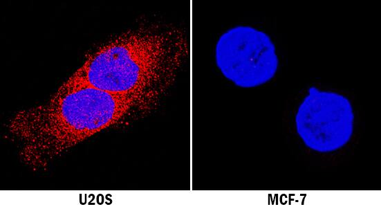 Laminin alpha 2 was detected in immersion fixed U2OS human osteosarcoma cell line (positive stain) and MCF-7 human breast cancer cell line (negative stain) using Mouse Anti-Human Laminin alpha 2 Monoclonal Antibody (Catalog # MAB2143) at 8 µg/mL for 3 hours at room temperature. Cells were stained using the NorthernLights™ 557-conjugated Anti-Mouse IgG Secondary Antibody (red; Catalog # NL007) and counterstained with DAPI (blue). Specific staining was localized to cytoplasm. View our protocol for Fluorescent ICC Staining of Cells on Coverslips.