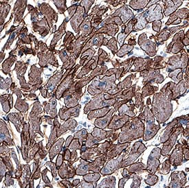 Laminin alpha 2 was detected in immersion fixed paraffin-embedded sections of human heart using Mouse Anti-Human Laminin alpha 2 Monoclonal Antibody (Catalog # MAB2143) at 5 µg/mL for 1 hour at room temperature followed by incubation with the Anti-Mouse IgG VisUCyte™ HRP Polymer Antibody (Catalog # VC001). Before incubation with the primary antibody, tissue was subjected to heat-induced epitope retrieval using Antigen Retrieval Reagent-Basic (Catalog # CTS013). Tissue was stained using DAB (brown) and counterstained with hematoxylin (blue). Specific staining was localized to cell membranes in cardiomyocytes. View our protocol for IHC Staining with VisUCyte HRP Polymer Detection Reagents.