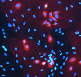 Laminin a3/Laminin-5 was detected in immersion fixed NHEK human normal epidermal keratinocytes treated with 10ng/mL Recombinant Human TGF-beta 1 (Catalog # 240-B) for 24 hours using Mouse Anti-Human Laminin a3/Laminin-5 Monoclonal Antibody (Catalog # MAB21441) at 10 µg/mL for 3 hours at room temperature. Cells were stained using the NorthernLights™ 557-conjugated Anti-Mouse IgG Secondary Antibody (red; Catalog # NL007) and counterstained with DAPI (blue). Specific staining was localized to the perinuclear space. View our protocol for Fluorescent ICC Staining of Cells on Coverslips.