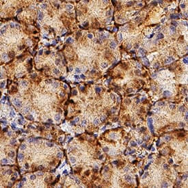 Immunohistochemistry Laminin alpha 3/Laminin-5 Antibody (546215) [Unconjugated]