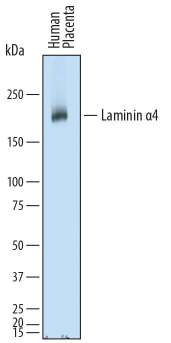 Western Blot Laminin alpha 4 Antibody [Unconjugated]