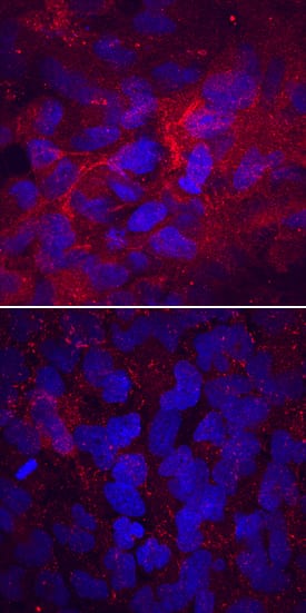 Laminin a4 was detected in immersion fixed T98G human glioblastoma cells cultured with (upper panel) or without (lower panel) StemXVivo EMT Inducing Media Supplement (Catalog # CCM017) using Mouse Anti-Human Laminin a4 Monoclonal Antibody (Catalog # MAB7340) at 10 µg/mL for 3 hours at room temperature. Cells were stained using the NorthernLights™ 557-conjugated Anti-Mouse IgG Secondary Antibody (red; Catalog # NL007) and counterstained with DAPI (blue). Specific staining was localized to cytoplasm. View our protocol for Fluorescent ICC Staining of Cells on Coverslips.