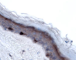 Langerin/CD207 was detected in immersion fixed paraffin-embedded sections of human skin using 15 &micro;g/mL Goat Anti-Human Langerin/CD207 Antigen Affinity-purified Polyclonal Antibody (Catalog # AF2088) overnight at 4 &deg;C. Tissue was stained with the Anti-Goat HRP-DAB Cell & Tissue Staining Kit (brown; Catalog # CTS008) and counterstained with hematoxylin (blue). Specific labeling was localized to the cytoplasm of Langerhans cells in the skin epidermis. View our protocol for Chromogenic IHC Staining of Paraffin-embedded Tissue Sections.