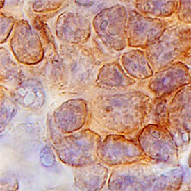 Lck was detected in immersion fixed paraffin-embedded sections of human thymus using Goat Anti-Human Lck Antigen Affinity-purified Polyclonal Antibody (Catalog # AF3704) at 3 µg/mL for 1 hour at room temperature followed by incubation with the Anti-Goat IgG VisUCyte™ HRP Polymer Antibody (VC004). Tissue was stained using DAB (brown) and counterstained with hematoxylin (blue). Specific staining was localized to plasma membrane. View our protocol for IHC Staining with VisUCyte HRP Polymer Detection Reagents.