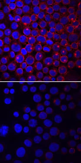 <b>Biological Strategies Validation. </b>Lck phosphorylated at Y505 was detected in immersion fixed Jurkat human acute T cell leukemia cell line stimulated (upper panel) or not (lower panel) with pervanadate using Mouse Anti-Human Phospho-Lck (Y505) Monoclonal Antibody (Catalog # MAB7369) at 10 µg/mL for 3 hours at room temperature. Cells were stained using the NorthernLights™ 557-conjugated Anti-Mouse IgG Secondary Antibody (red; Catalog # NL007) and counterstained with DAPI (blue). Specific staining was localized to cell surfaces and cytoplasm. View our protocol for Fluorescent ICC Staining of Non-adherent Cells.