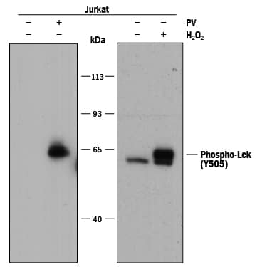 Western blot shows lysates of Jurkat human acute T cell leukemia cell line untreated (-) or treated (+) with 1 mM Pervanadate (PV) for 10 minutes or 2mM H2O2for 2 minutes. PVDF membrane was probed with 0.5 µg/mL of Mouse Anti-Human Phospho-Lck (Y505) Monoclonal Antibody (Catalog # MAB7369) followed by HRP-conjugated Anti-Mouse IgG Secondary Antibody (Catalog # HAF018). A specific band was detected for Phospho-Lck (Y505) at approximately 62 kDa (as indicated). This experiment was conducted under reducing conditions and using Immunoblot Buffer Group 1.