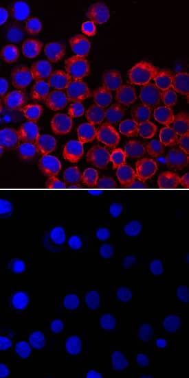 Immunocytochemistry Lck [p Tyr394] Antibody (755103)