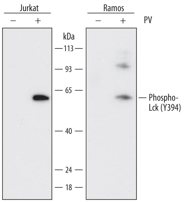 Western Blot Lck [p Tyr394] Antibody (755103)