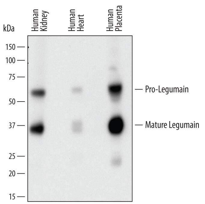 Western Blot Legumain/Asparaginyl Endopeptidase Antibody [Unconjugated]