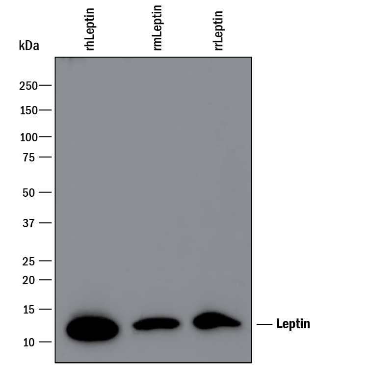 Western blot shows 100 ng of Recombinant Human Leptin/OB (Catalog # 398-LP), Recombinant Mouse Leptin/OB (Catalog # 498-OB) and Recombinant Rat Leptin/OB (Catalog # 598-LP). PVDF Membrane was probed with 0.1 µg/mL of Goat Anti-Human Leptin/OB Antigen Affinity-purified Polyclonal Antibody (Catalog # AF398) followed by HRP-conjugated Anti-Goat IgG Secondary Antibody (Catalog # HAF109). A specific band was detected for Leptin/OB at approximately 12 kDa (as indicated). This experiment was conducted under reducing conditions and using Immunoblot Buffer Group 3.