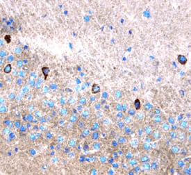 Leptin/OB was detected in perfusion fixed frozen sections of mouse brain using Mouse Leptin/OB Antigen Affinity-purified Polyclonal Antibody (Catalog # AF498) at 5 µg/mL overnight at 4 °C. Tissue was stained using the Anti-Goat HRP-DAB Cell & Tissue Staining Kit (brown; CTS008) and counterstained with hematoxylin (blue). Specific staining was localized to neuronal cytoplasm. View our protocol for Chromogenic IHC Staining of Frozen Tissue Sections.