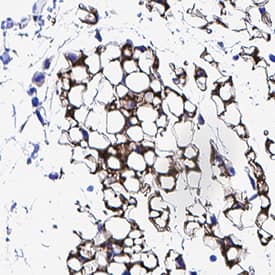 Leptin/OB was detected in immersion fixed paraffin-embedded sections of mouse adipose tissue using Rabbit Anti-Mouse Leptin/OB Monoclonal Antibody (Catalog # MAB498) at 3 µg/mL for 1 hour at room temperature followed by incubation with the Anti-Rabbit IgG VisUCyte™ HRP Polymer Antibody (Catalog # VC003). Before incubation with the primary antibody, tissue was subjected to heat-induced epitope retrieval using Antigen Retrieval Reagent-Basic (Catalog # CTS013). Tissue was stained using DAB (brown) and counterstained with hematoxylin (blue). Specific staining was localized to cytoplasm in fat cells. View our protocol for IHC Staining with VisUCyte HRP Polymer Detection Reagents.