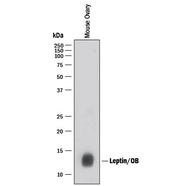 Western blot shows lysates of mouse ovary tissue. PVDF membrane was probed with 1 µg/mL of Rabbit Anti-Mouse Leptin/OB Monoclonal Antibody (Catalog # MAB498) followed by HRP-conjugated Anti-Rabbit IgG Secondary Antibody (Catalog # HAF008). A specific band was detected for Leptin/OB at approximately 16 kDa (as indicated). This experiment was conducted under reducing conditions and using Immunoblot Buffer Group 1.