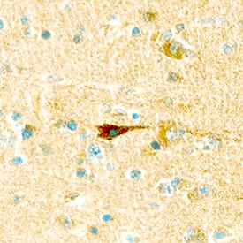Leptin R was detected in immersion fixed paraffin-embedded sections of human brain using Goat Anti-Human Leptin R Antigen Affinity-purified Polyclonal Antibody (Catalog # AF389) at 25 µg/mL overnight at 4 °C. Tissue was stained using the Anti-Goat HRP-DAB Cell & Tissue Staining Kit (brown; Catalog # CTS008) and counterstained with hematoxylin (blue). Specific staining was localized to neurons. View our protocol for Chromogenic IHC Staining of Paraffin-embedded Tissue Sections.