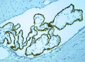 Immunohistochemistry Leptin R Antibody [Unconjugated]