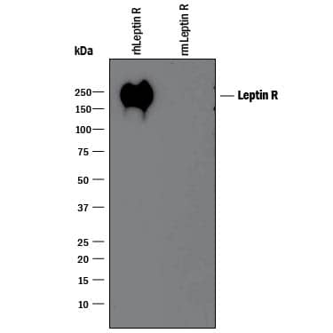 Western blot shows 25 ng of Recombinant Human Leptin R Fc Chimera (Catalog # 389-LR) and Recombinant Mouse Leptin R Fc Chimera (Catalog # 497-LR). PVDF Membrane was probed with 1 µg/mL of Mouse Anti-Human Leptin R Monoclonal Antibody (Catalog # MAB867) followed by HRP-conjugated Anti-Mouse IgG Secondary Antibody (Catalog # HAF007). A specific band was detected for Leptin R at approximately 155-200 kDa (as indicated). This experiment was conducted under reducing conditions and using Immunoblot Buffer Group 3.