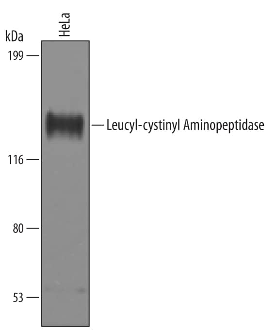Western Blot Leucyl-cystinyl Aminopeptidase/LNPEP Antibody