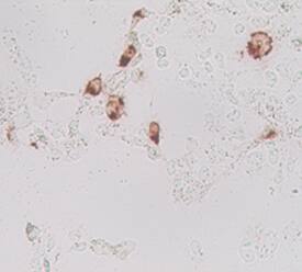 Lgr5/GPR49 was detected in immersion fixed MYC tagged mouse transfectants using Mouse Anti-Human Lgr5/GPR49 Monoclonal Antibody (Catalog # MAB8078). Cells were stained using an anti-mouse HRP-conjugated secondary antibody (brown). Specific staining was localized to cytoplasm.Image courtesy of Dr. Hans Clevers, Hubrecht Institute, The Netherlands.
