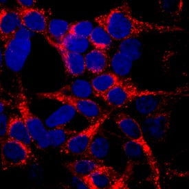Lgr6 was detected in immersion fixed HEK293 human embryonic kidney cell line transfected with Lgr6 using Mouse Anti-Human Lgr6 Monoclonal Antibody (Catalog # MAB84581) at 10 µg/mL for 3 hours at room temperature. Cells were stained using the NorthernLights™ 557-conjugated Anti-Mouse IgG Secondary Antibody (red; Catalog # NL007) and counterstained with DAPI (blue). Specific staining was localized to cytoplasm. View our protocol for Fluorescent ICC Staining of Cells on Coverslips.