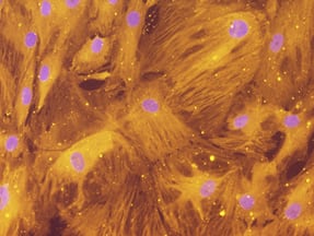 Lipin 1 was detected in immersion fixed human mesenchymal stem cell-derived adipocytes using Goat Anti-Human Lipin 1 Antigen Affinity-purified Polyclonal Antibody (Catalog # AF3885) at 10 µg/mL for 3 hours at room temperature. Cells were stained using the NorthernLights™ 557-conjugated Anti-Goat IgG Secondary Antibody (yellow; Catalog # NL001) and counterstained with DAPI (blue). Specific staining was localized to cytoplasm. View our protocol for Fluorescent ICC Staining of Cells on Coverslips.