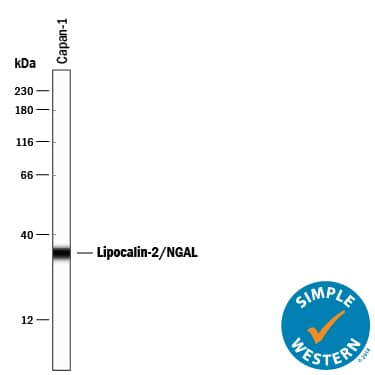 Simple Western lane view shows lysates of Capan-1 human pancreatic adenocarcinoma cell line, loaded at 0.2 mg/mL. A specific band was detected for Lipocalin-2/NGAL at approximately 34 kDa (as indicated) using 2 µg/mL of Goat Anti-Human/Mouse/Rat Lipocalin-2/NGAL Antigen Affinity-purified Polyclonal Antibody (Catalog # AF1757) followed by 1:50 dilution of HRP-conjugated Anti-Goat IgG Secondary Antibody (Catalog # HAF109). This experiment was conducted under reducing conditions and using the 12-230 kDa separation system.