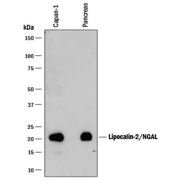 Western blot shows lysates of Capan-1 human pancreatic adenocarcinoma cell line and human pancreas tissue. PVDF membrane was probed with 0.2 µg/mL of Goat Anti-Human/Mouse/Rat Lipocalin-2/NGAL Antigen Affinity-purified Polyclonal Antibody (Catalog # AF1757) followed by HRP-conjugated Anti-Goat IgG Secondary Antibody (Catalog # HAF109). A specific band was detected for Lipocalin-2/NGAL at approximately 22 kDa (as indicated). This experiment was conducted under reducing conditions and using Immunoblot Buffer Group 1.