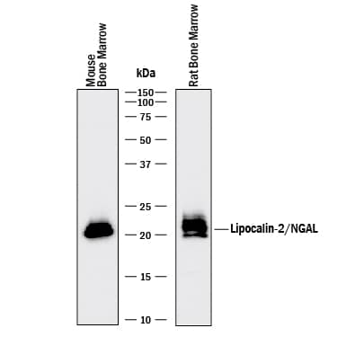 Western blot shows lysates of mouse and rat bone marrow. PVDF membrane was probed with 0.2 µg/mL of Goat Anti-Human/Mouse/Rat Lipocalin-2/NGAL Antigen Affinity-purified Polyclonal Antibody (Catalog # AF1757) followed by HRP-conjugated Anti-Goat IgG Secondary Antibody (Catalog # HAF017). A specific band was detected for Lipocalin-2/NGAL at approximately 22 kDa (as indicated). This experiment was conducted under reducing conditions and using Immunoblot Buffer Group 1.