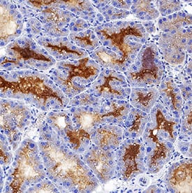 Lipocalin-2/NGAL was detected in perfusion fixed frozen sections of mouse mammary gland using Goat Anti-Mouse Lipocalin-2/NGAL Antigen Affinity-purified Polyclonal Antibody (Catalog # AF1857) at 3 µg/mL for 1 hour at room temperature followed by incubation with the Anti-Goat IgG VisUCyte™ HRP Polymer Antibody (VC004). Tissue was stained using DAB (brown) and counterstained with hematoxylin (blue). Specific staining was localized to extracellular areas in ducts. View our protocol for IHC Staining with VisUCyte HRP Polymer Detection Reagents.