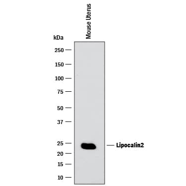 Western blot shows lysates of mouse uterus tissue. PVDF membrane was probed with 0.25 µg/mL of Goat Anti-Mouse Lipocalin-2/NGAL Antigen Affinity-purified Polyclonal Antibody (Catalog # AF1857) followed by HRP-conjugated Anti-Goat IgG Secondary Antibody (HAF017). A specific band was detected for Lipocalin-2/NGAL at approximately 24 kDa (as indicated). This experiment was conducted under reducing conditions and using Immunoblot Buffer Group 1.