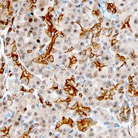 Lipocalin-2/NGAL was detected in immersion fixed paraffin-embedded sections of human pancreas using Rat Anti-Human Lipocalin-2/NGAL Monoclonal Antibody (Catalog # MAB1757) at 15 µg/mL overnight at 4 °C. Tissue was stained using the Anti-Rabbit HRP-DAB Cell & Tissue Staining Kit (brown; Catalog # CTS005) and counterstained with hematoxylin (blue). Specific staining was localized to plasma membrane of ductal cells. View our protocol for Chromogenic IHC Staining of Paraffin-embedded Tissue Sections.