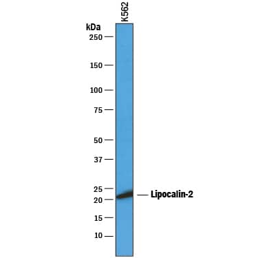 Western blot shows lysates of K562 human chronic myelogenous leukemia cell line. PVDF membrane was probed with 1 µg/mL of Rat Anti-Human Lipocalin-2/NGAL Monoclonal Antibody (Catalog # MAB1757) followed by HRP-conjugated Anti-Rat IgG Secondary Antibody (Catalog # HAF005). A specific band was detected for Lipocalin-2/NGAL at approximately 22 kDa (as indicated). This experiment was conducted under reducing conditions and using Immunoblot Buffer Group 1.