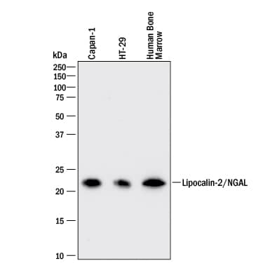 Western blot shows lysates of Capan-1 human pancreatic adenocarcinoma cell line, HT-29 human colon adenocarcinoma cell line, and human bone marrow tissue. PVDF membrane was probed with 0.2 µg/mL of Rat Anti-Human Lipocalin-2/NGAL Monoclonal Antibody (Catalog # MAB1757) followed by HRP-conjugated Anti-Rat IgG Secondary Antibody (Catalog # HAF005). A specific band was detected for Lipocalin-2/NGAL at approximately 22 kDa (as indicated). This experiment was conducted under reducing conditions and using Immunoblot Buffer Group 1.