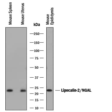 Western blot shows lysates of mouse spleen tissue, mouse uterus tissue, and mouse epididymis tissue. PVDF membrane was probed with 0.5 µg/mL of Rat Anti-Mouse Lipocalin-2/NGAL Monoclonal Antibody (Catalog # MAB1857) followed by HRP-conjugated Anti-Rat IgG Secondary Antibody (Catalog # HAF005). A specific band was detected for Lipocalin-2/NGAL at approximately 23 kDa (as indicated). This experiment was conducted under reducing conditions and using Immunoblot Buffer Group 1.