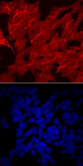 Lipoprotein Lipase/LPL was detected in immersion fixed SH-SY5Y human neuroblastoma cell line using Goat Anti-Human Lipoprotein Lipase/LPL Antigen Affinity-purified Polyclonal Antibody (Catalog # AF7197) at 10 µg/mL for 3 hours at room temperature. Cells were stained using the NorthernLights™ 557-conjugated Anti-Goat IgG Secondary Antibody (red, upper panel; Catalog # NL001) and counterstained with DAPI (blue, lower panel). Specific staining was localized to cell surfaces and cytoplasm. View our protocol for Fluorescent ICC Staining of Cells on Coverslips. This application has not been tested in mouse samples.