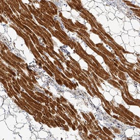 Lipoprotein Lipase/LPL was detected in immersion fixed paraffin-embedded sections of human heart using Goat Anti-Human/Mouse Lipoprotein Lipase/LPL Antigen Affinity-purified Polyclonal Antibody (Catalog # AF7197) at 3 µg/mL for 1 hour at room temperature followed by incubation with the Anti-Goat IgG VisUCyte™ HRP Polymer Antibody (Catalog # VC004). Tissue was stained using DAB (brown) and counterstained with hematoxylin (blue). Specific staining was localized to cardiomyocytes. View our protocol for IHC Staining with VisUCyte HRP Polymer Detection Reagents.