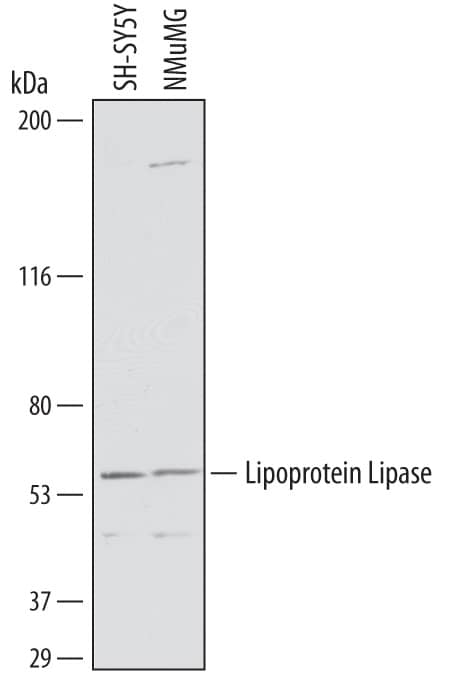 Western blot shows lysates of SH-SY5Y human neuroblastoma cell line and NMuMG mouse mammary gland epithelial cell line. PVDF membrane was probed with 1 µg/mL of Goat Anti-Human Lipoprotein Lipase/LPL Antigen Affinity-purified Polyclonal Antibody (Catalog # AF7197) followed by HRP-conjugated Anti-Goat IgG Secondary Antibody (Catalog # HAF019). A specific band was detected for Lipoprotein Lipase/LPL at approximately 56 kDa (as indicated). This experiment was conducted under reducing conditions and using Immunoblot Buffer Group 1.