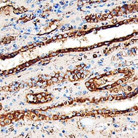 Immunohistochemistry Lumican Antibody [Unconjugated]