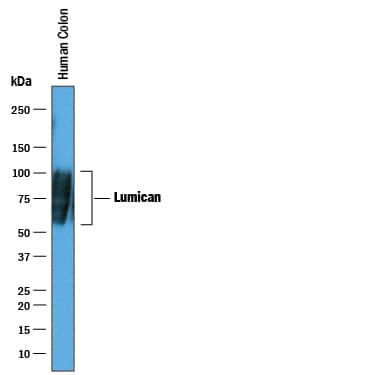Western Blot Lumican Antibody [Unconjugated]