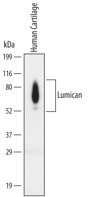 Western blot shows lysates of human cartilage tissue. PVDF Membrane was probed with 2 µg/mL of Human Lumican Monoclonal Antibody (Catalog # MAB28461) followed by HRP-conjugated Anti-Mouse IgG Secondary Antibody (Catalog # HAF007). Differentially glycosylated Lumican protein species were detected between 65 and 85 kDa (as indicated). This experiment was conducted under non-reducing conditions and using Immunoblot Buffer Group 1.