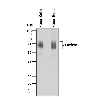 Western blot shows lysates of human colon tissue and human heart tissue. PVDF membrane was probed with 2 µg/mL of Mouse Anti-Human/Mouse Lumican Monoclonal Antibody (Catalog # MAB2846) followed by HRP-conjugated Anti-Mouse IgG Secondary Antibody (Catalog # HAF018). A specific band was detected for Lumican at approximately 60-85 kDa (as indicated). This experiment was conducted under reducing conditions and using Immunoblot Buffer Group 1.