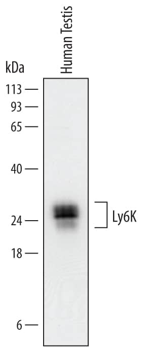 Western Blot Ly6K Antibody