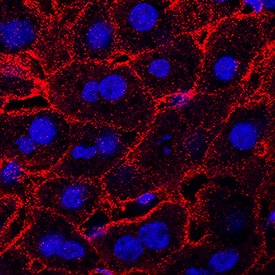 Lymphotoxin  beta R/TNFRSF3 was detected in perfusion fixed frozen sections of mouse liver using Sheep Anti-Mouse Lymphotoxin  beta R/TNFRSF3 Antigen Affinity-purified Polyclonal Antibody (Catalog # AF10081) at 1.7 µg/mL overnight at 4 °C. Tissue was stained using the NorthernLights™ 557-conjugated Anti-Sheep IgG Secondary Antibody (red; Catalog # NL010) and counterstained with DAPI (blue). Specific staining was localized to cell surfaces in hepatocytes. View our protocol for Fluorescent IHC Staining of Frozen Tissue Sections.