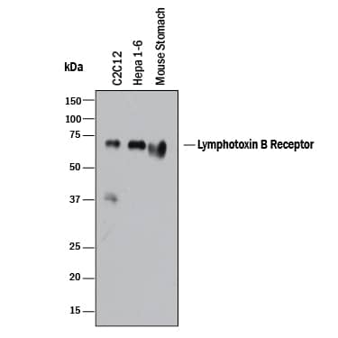 Western blot shows lysates of C2C12 mouse myoblast cell line. PVDF membrane was probed with 2 µg/mL of Sheep Anti-Mouse Lymphotoxin  beta R/TNFRSF3 Antigen Affinity-purified Polyclonal Antibody (Catalog # AF10081) followed by HRP-conjugated Anti-Sheep IgG Secondary Antibody (Catalog # HAF016). A specific band was detected for Lymphotoxin  beta R/TNFRSF3 at approximately 72 kDa (as indicated). This experiment was conducted under reducing conditions and using Immunoblot Buffer Group 1.