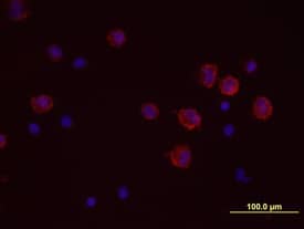 Immunocytochemistry Lyn Antibody [Unconjugated]