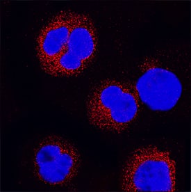 Lyn was detected in immersion fixed Raji human Burkitt's lymphoma cell line using Mouse Anti-Human/Rat Lyn Monoclonal Antibody (Catalog # MAB3206) at 25 µg/mL for 3 hours at room temperature. Cells were stained using the NorthernLights™ 557-conjugated Anti-Mouse IgG Secondary Antibody (red; Catalog # NL007) and counterstained with DAPI (blue). Specific staining was localized to cytoplasm. View our protocol for Fluorescent ICC Staining of Non-adherent Cells.