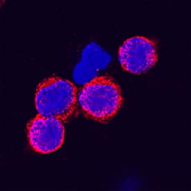 Immunocytochemistry Lyp/PTPN22 Antibody [Unconjugated]