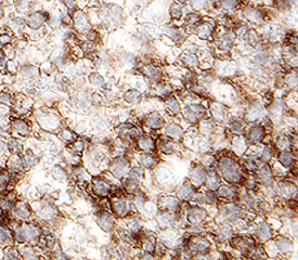 Lyp was detected in immersion fixed paraffin-embedded sections of human lymph node using 25 µg/mL Mouse Anti-Human Lyp Monoclonal Antibody (Catalog # MAB3428) overnight at 4 °C. Tissue was stained with the Anti-Mouse HRP-DAB Cell & Tissue Staining Kit (brown; Catalog # CTS002) and counterstained with hematoxylin (blue). View our protocol for Chromogenic IHC Staining of Paraffin-embedded Tissue Sections.