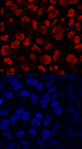 KDM4A was detected in immersion fixed endoderm-differentiated BG01V human embryonic stem cells using Human/Mouse KDM4A Affinity-purified Polyclonal Antibody (Catalog # AF6434) at 10 µg/mL for 3 hours at room temperature. Cells were stained using the NorthernLights™ 557-conjugated Anti-Sheep IgG Secondary Antibody (red, upper panel; Catalog # NL010) and counterstained with DAPI (blue, lower panel). Specific staining was localized to nuclei. View our protocol for Fluorescent ICC Staining of Cells on Coverslips.